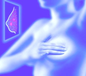 Виды рака груди
