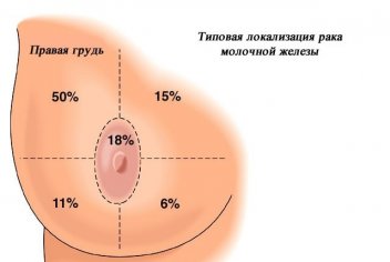 Рак молочной железы причины симптомы лечение - No-onco.ru