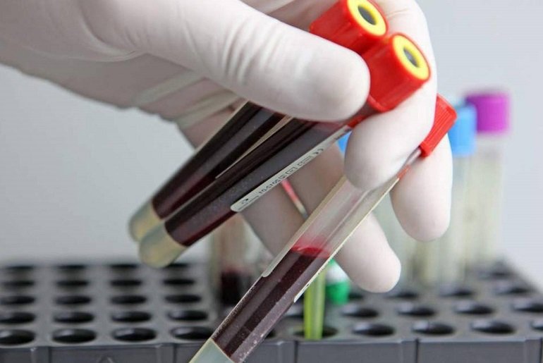 Стартап Grail: диагностировать рак поможет анализ крови