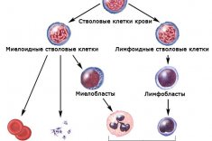 Миелоидный лейкоз