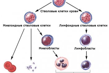 Миелоидный лейкоз - No-onco.ru