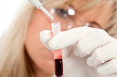Анализ крови на онкомаркеры