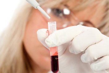 Анализ крови на онкомаркеры - No-onco.ru