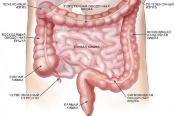 Симптомы рака кишечника - No-onco.ru