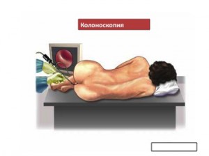 Диагностика опухоли прямой кишки у женщин