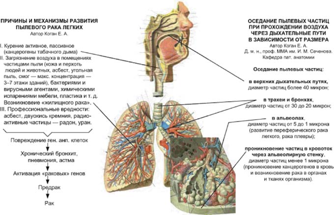 Рак легкого симптомы сколько живут