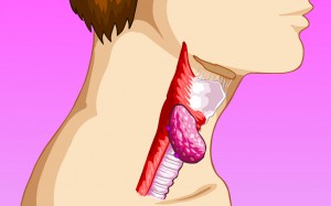 Проявление опухоли среднего отдела гортани