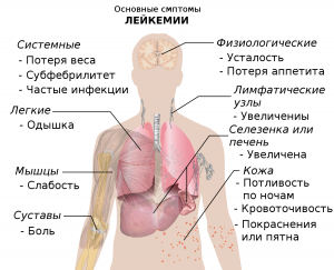 Симптомы рака крови