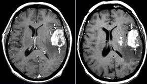 Рентгенография головного мозга