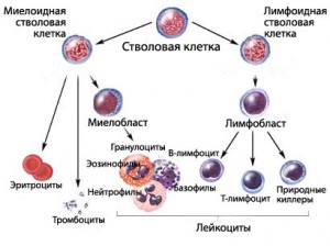 Хроническая миелоидная лейкемия