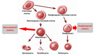 Лейкоз