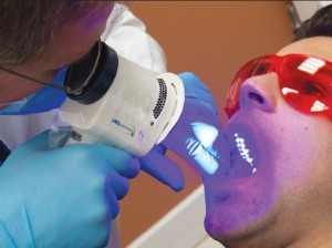 Лучевая терапия рака слизистой рта
