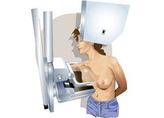 Mamografia como se hace