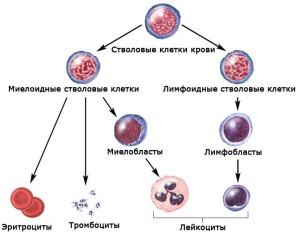 Миелоидный лейкоз