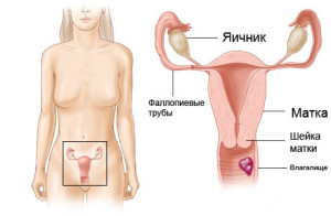 Стадии рака влагалища