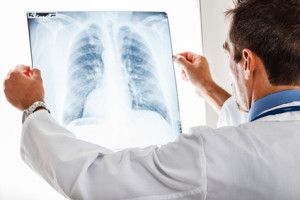 Лечение рака лёгких